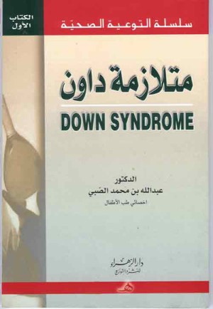 متلازمة داون Down Syndrome