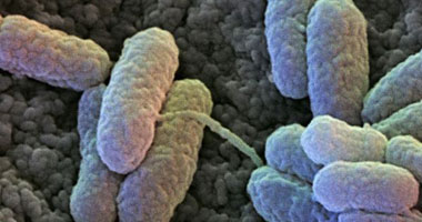 مرض التصلب المتعدد يسببه سم تفرزه بكتيريا غذائية